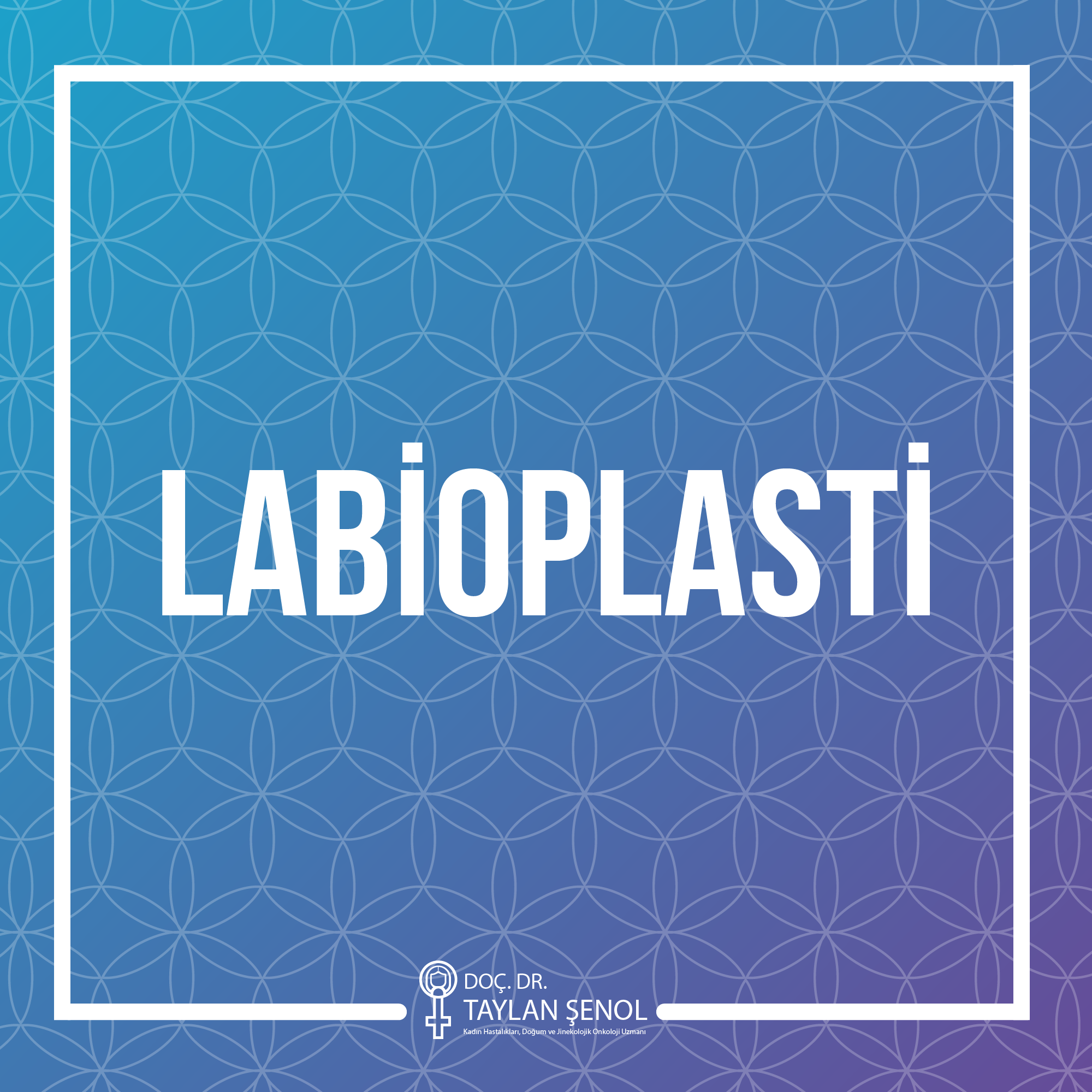 Labioplasti